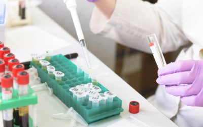 Bekämpfung des Coronavirus: Testkapazitäten massiv ausweiten!